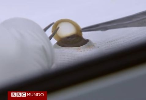 Cómo se extraen y almacenan córneas para transplantar - BBC Mundo